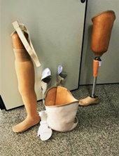 Pacientes amputados recebem próteses e órteses